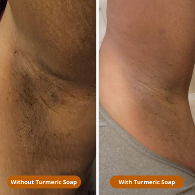 SET TURMERIC- MANOUGLOW