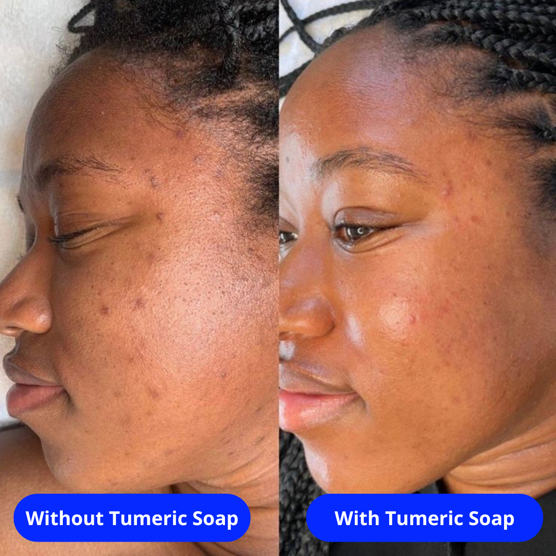 PACK MANOUGLOW (Turmeric Soap + Body butter)