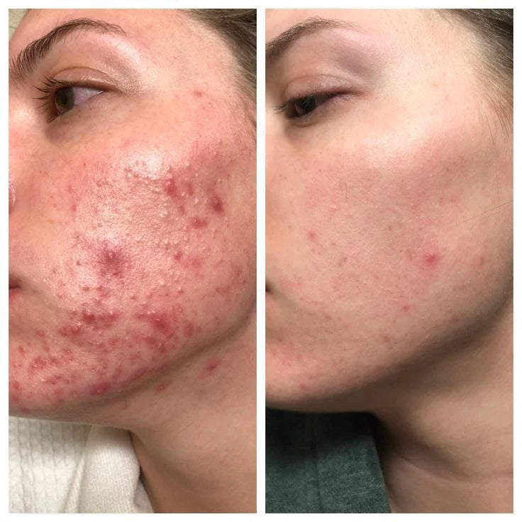 TURMERIC CLEANSER FOAM - MANOUGLOW