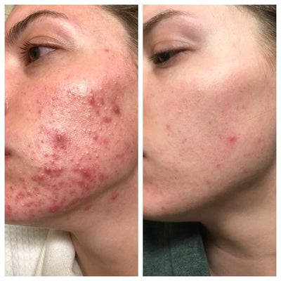 TURMERIC CLEANSER FOAM - MANOUGLOW